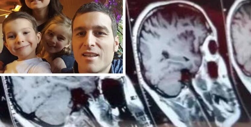 Lucas, el niño que venció lo imposible: cáncer cerebral